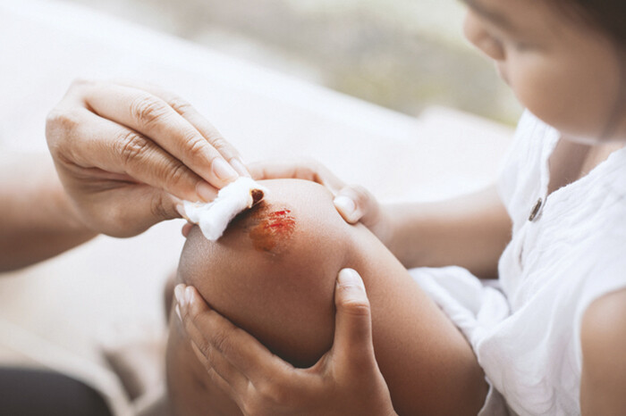 Alertan sobre la hemofilia: dolor limita 90% de actividades físicas de los pacientes