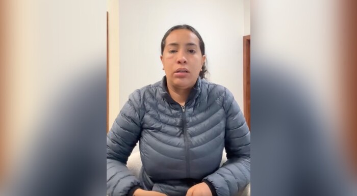 Arrojan ácido a mujer emprendedora en Tijuana