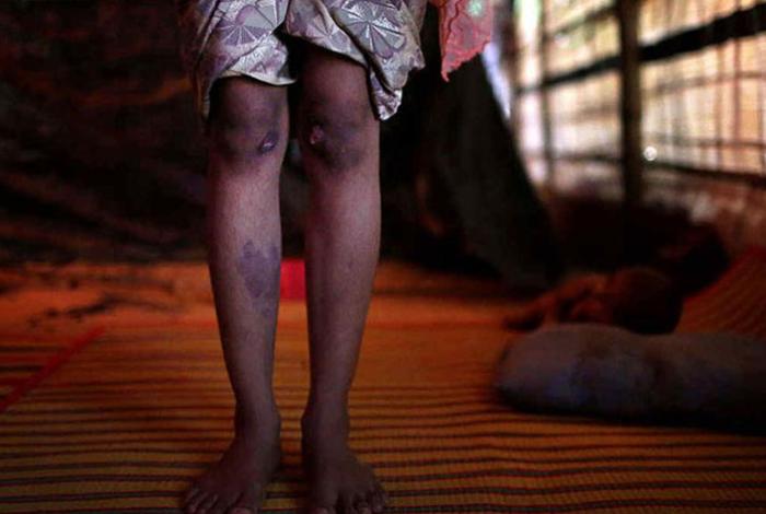 Condenan a albañil por violar a su sobrina de 6 años en Apatzingán