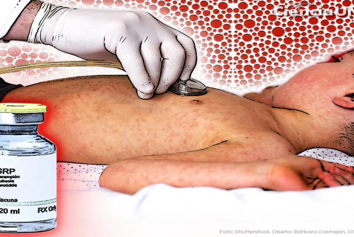 De la erradicación al rebrote: el desafío del sarampión en México