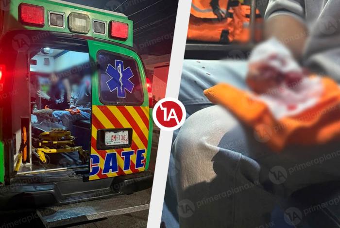 Festeja la Navidad con pirotecnia y le expl0ta cohete en la mano, en Uruapan