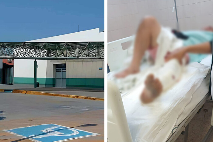 Hombre se lesiona al manipular arma prestada, en Buenavista