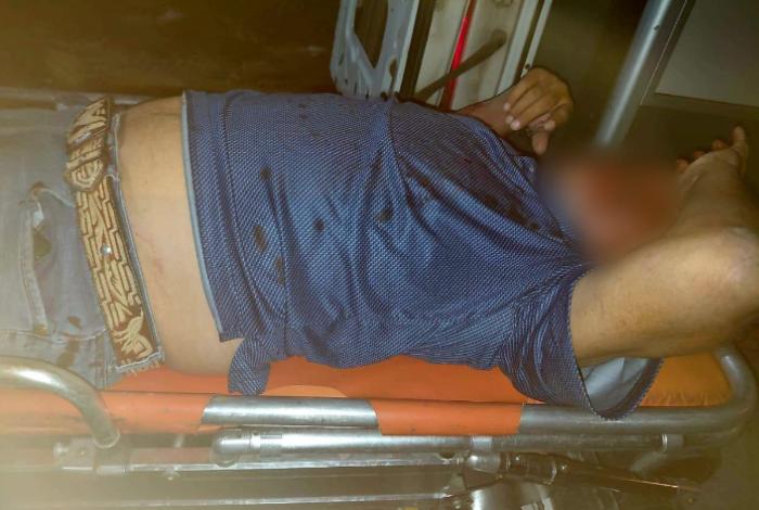 Motociclista resulta gravemente lesionado tras derrape en Apatzingán