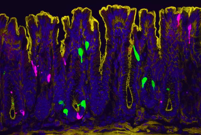 ¿Por qué las mujeres sufren más dolor intestinal en comparación con los hombres?, la respuesta está en el estrógeno
